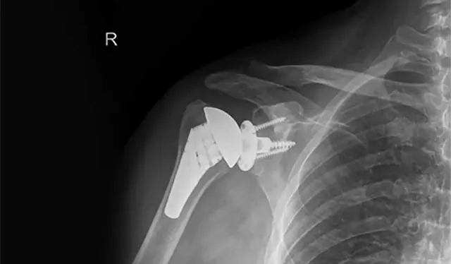 Ιωάννης Πολυζώης – Ορθοπαιδικός Χειρουργός