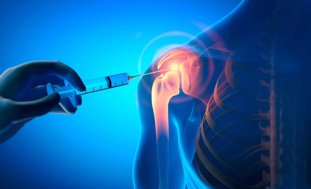 Ιωάννης Πολυζώης – Ορθοπαιδικός Χειρουργός