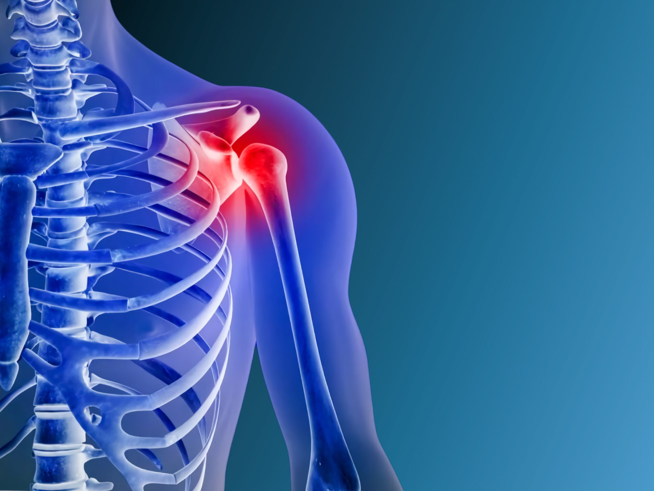 Ιωάννης Πολυζώης – Ορθοπαιδικός Χειρουργός