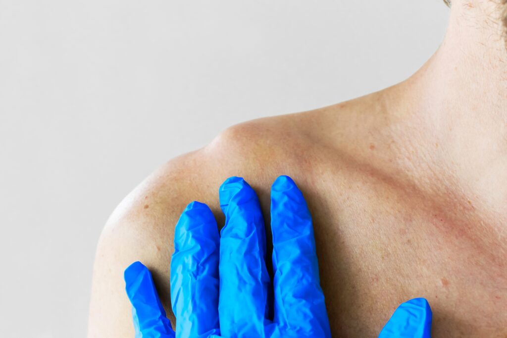 Κάταγμα Κλείδας