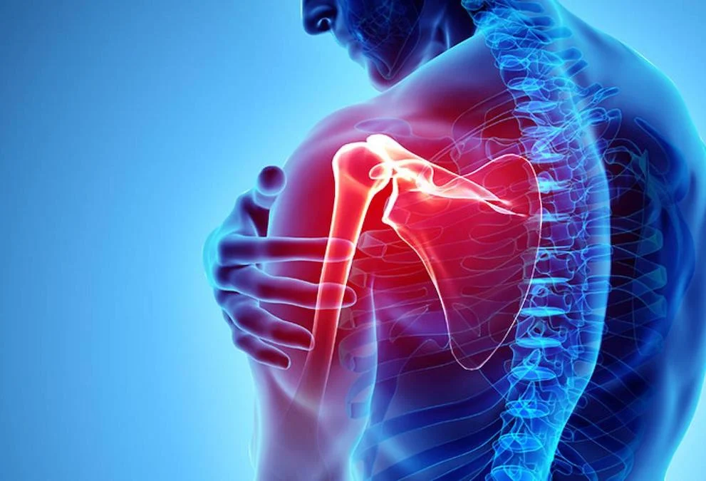 Πόνος στον ώμο τι πρέπει να κάνετε