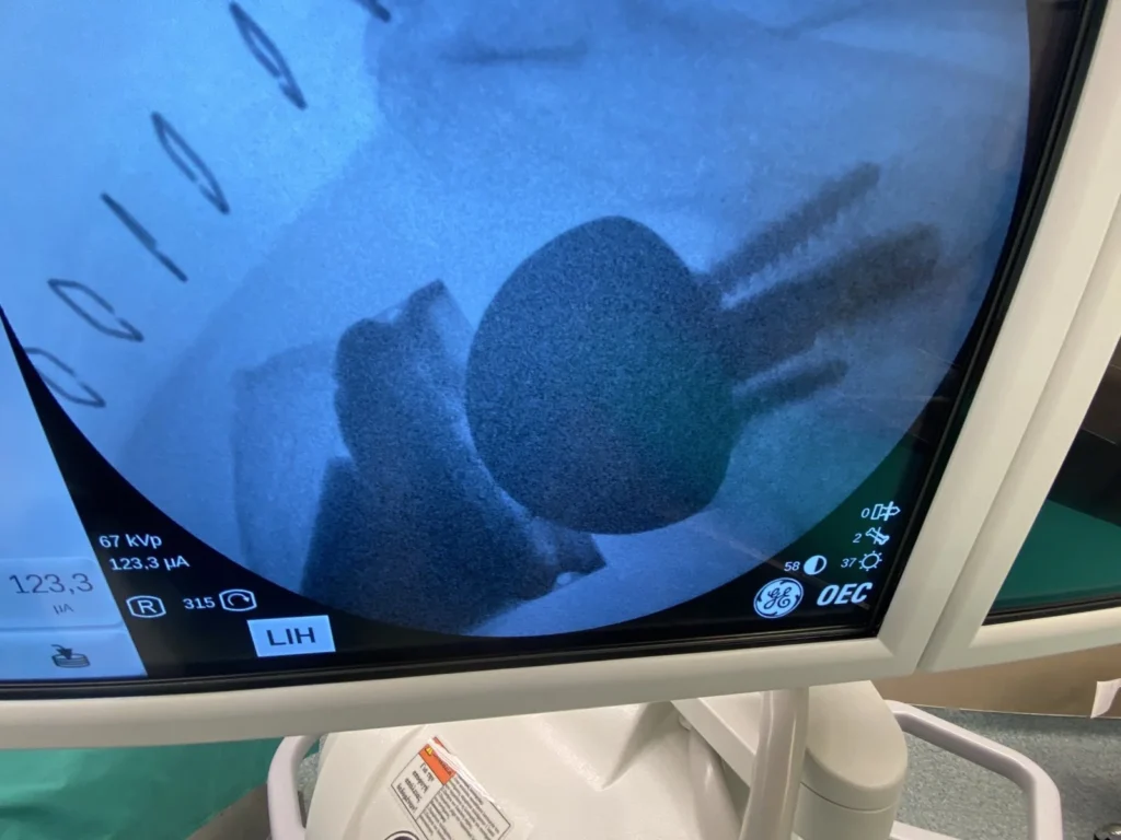 Ιωάννης Πολυζώης – Ορθοπαιδικός Χειρουργός