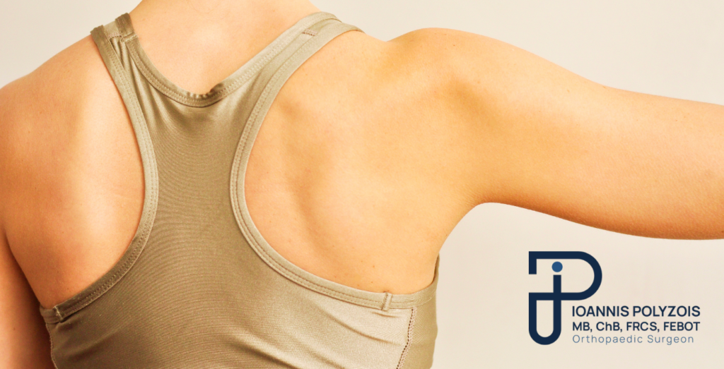 Ιατρική απεικόνιση παγωμένου ώμου με περιορισμό εύρους κίνησης